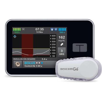 Tandem Insulin Pump With Control IQ Technology